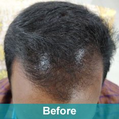 Heera Skin and Hair Clinic gallery