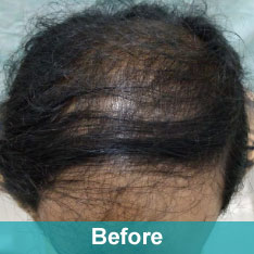 Heera Skin and Hair Clinic gallery