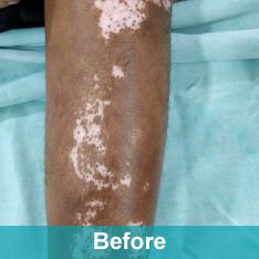 Heera Skin and Hair Clinic gallery