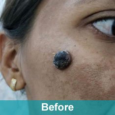 Heera Skin and Hair Clinic gallery