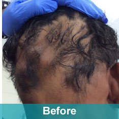 Heera Skin and Hair Clinic gallery