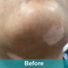 Heera Skin and Hair Clinic gallery